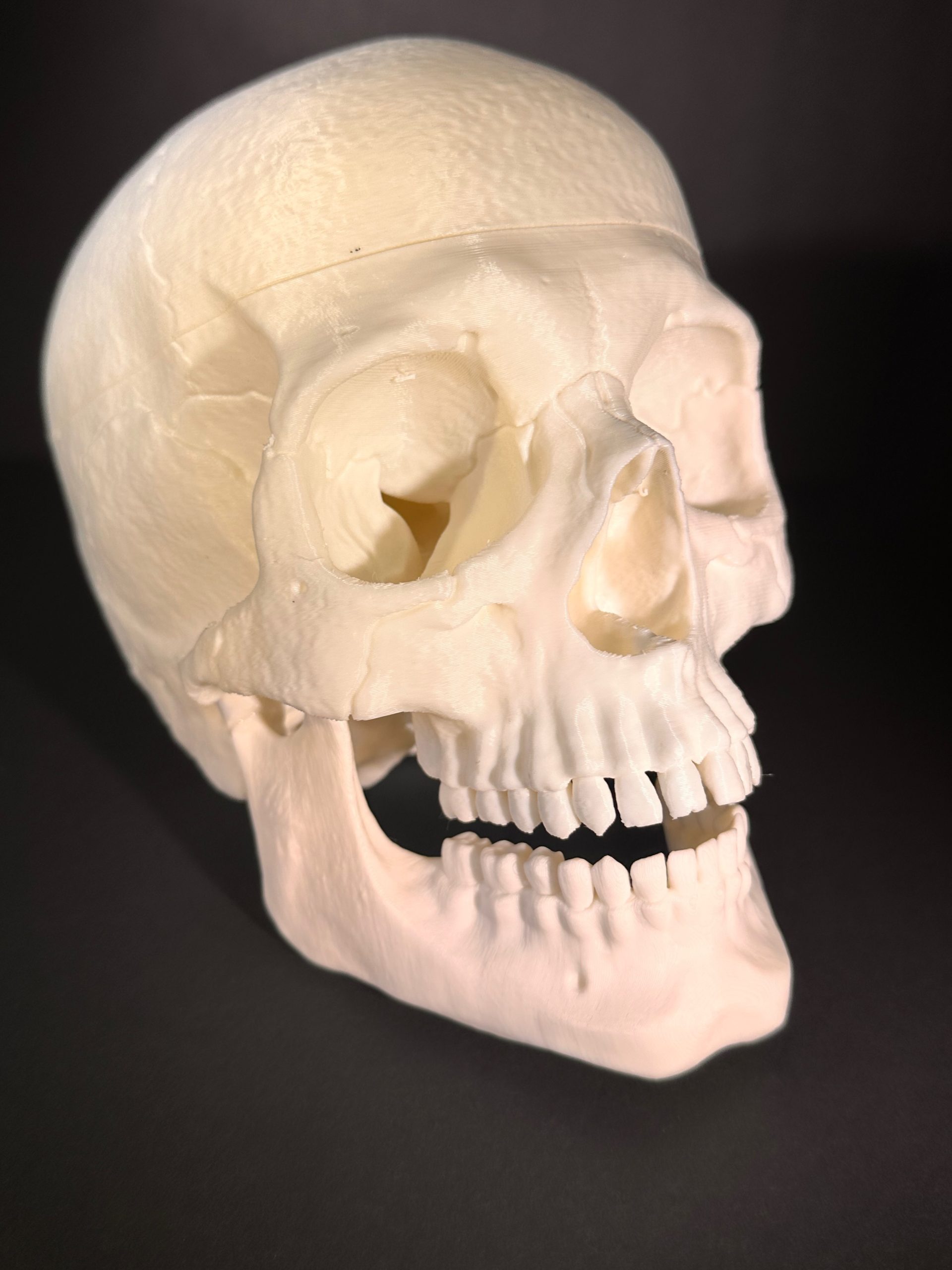 Skull
